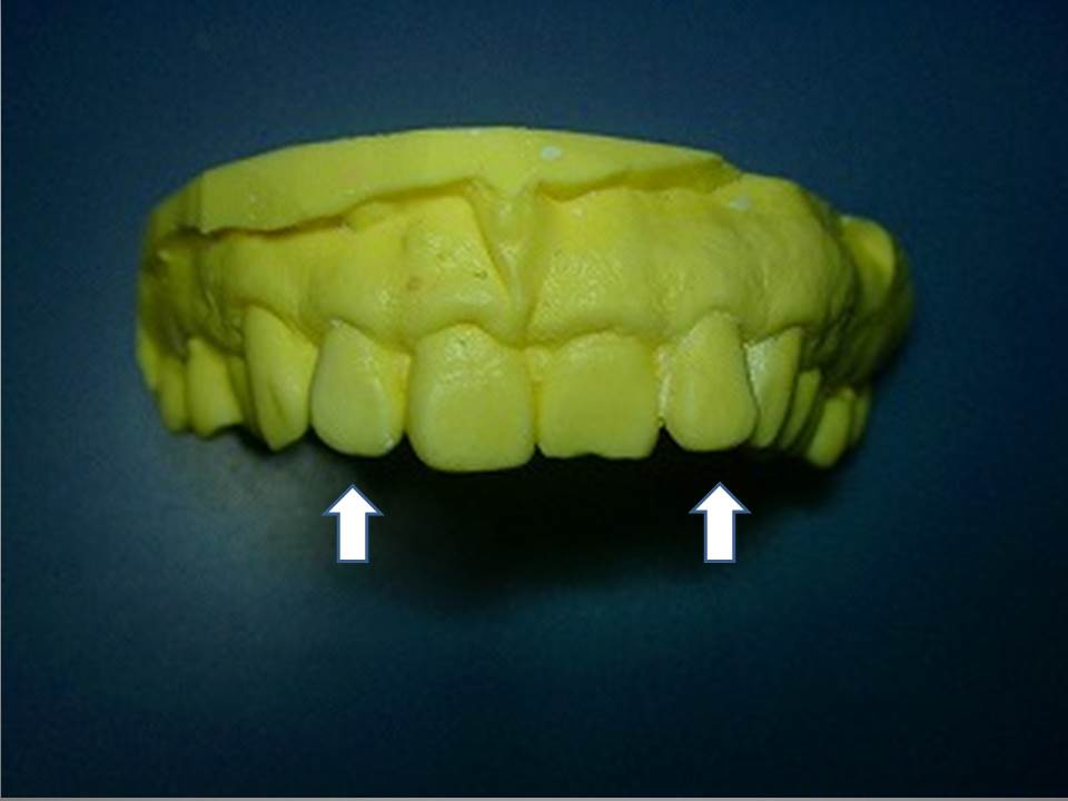 �A�N�A����(���ʊρj