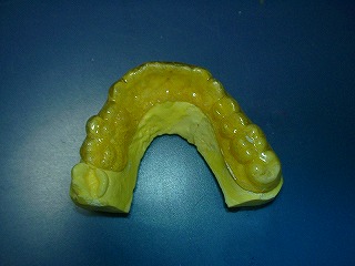 �g���[����(�����ʊ�)