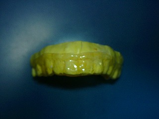 �g���[����(���ʊ�)