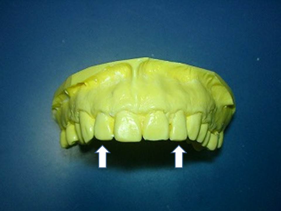 ������(���ʊ�)