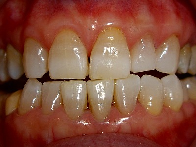 �z���C�g�j���O���ÑO