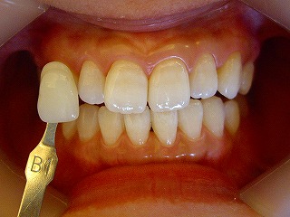 �Ђ���Ǝˌ�